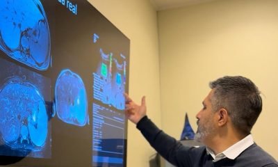hospital puerto montt implementa elastografia hepatica avanzada