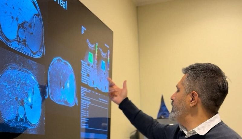 hospital puerto montt implementa elastografia hepatica avanzada
