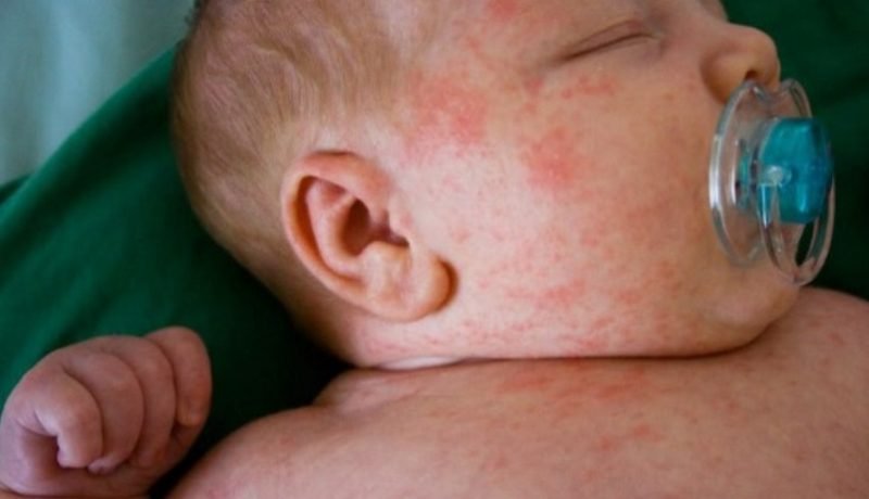desabastecimiento de formula para bebes crisis sanitaria y economica en chile