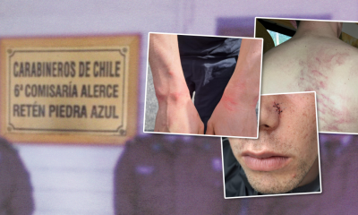 joven con autismo denuncia agresión policial y amenazas en puerto montt