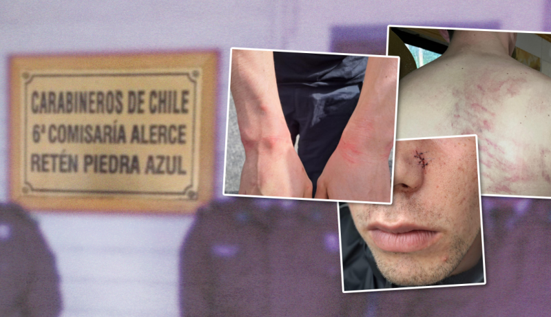 joven con autismo denuncia agresión policial y amenazas en puerto montt