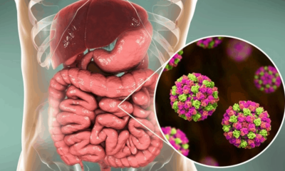 alerta por norovirus en los lagos: expertos llaman a extremar higiene